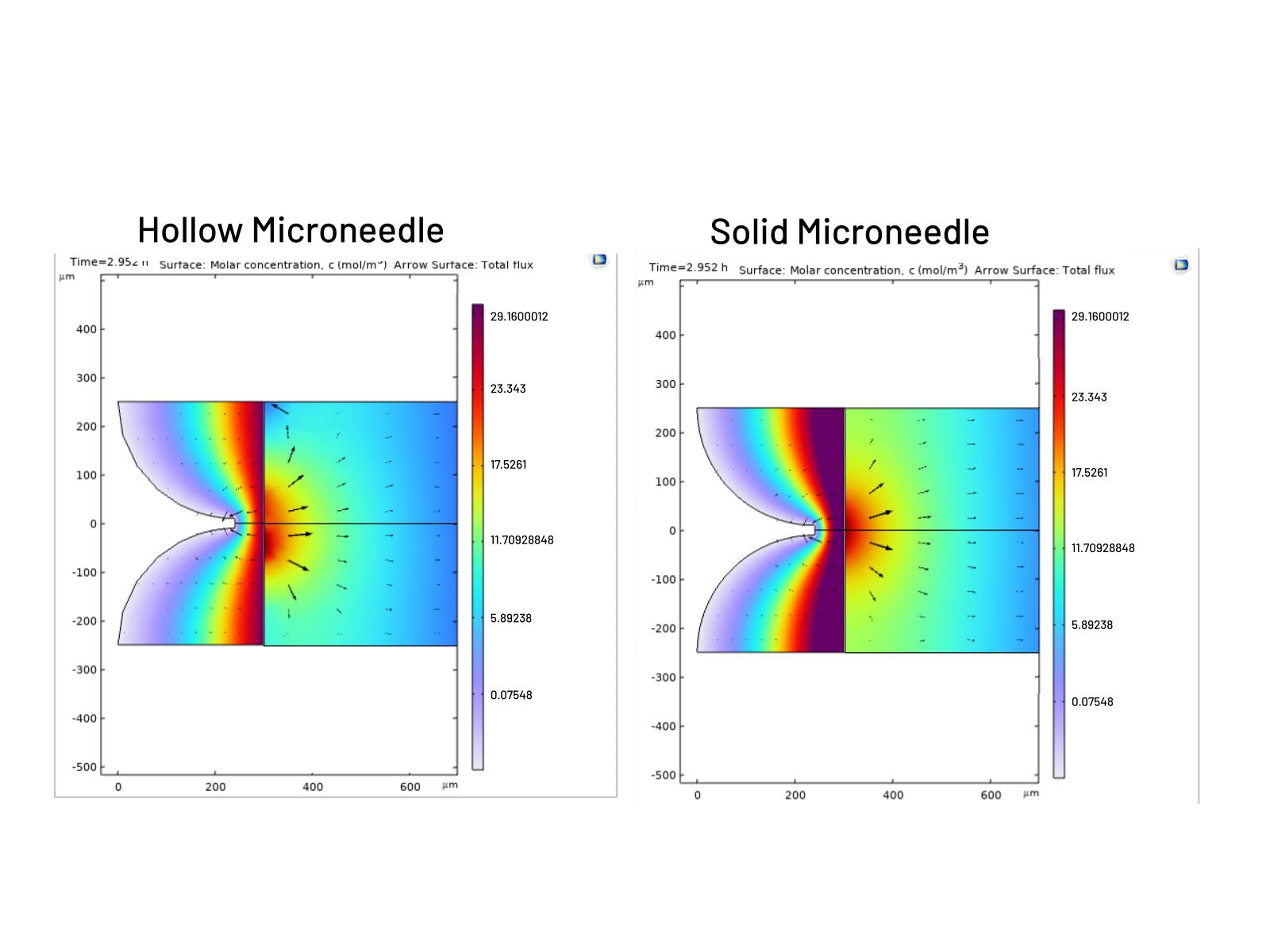 COMSOL Microneedle Analysis